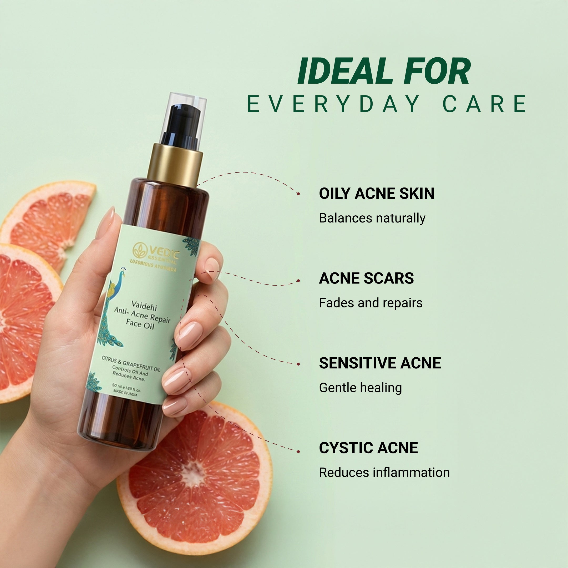 Vaidehi Anti- Acne Repair Face Oil - 30 ml
